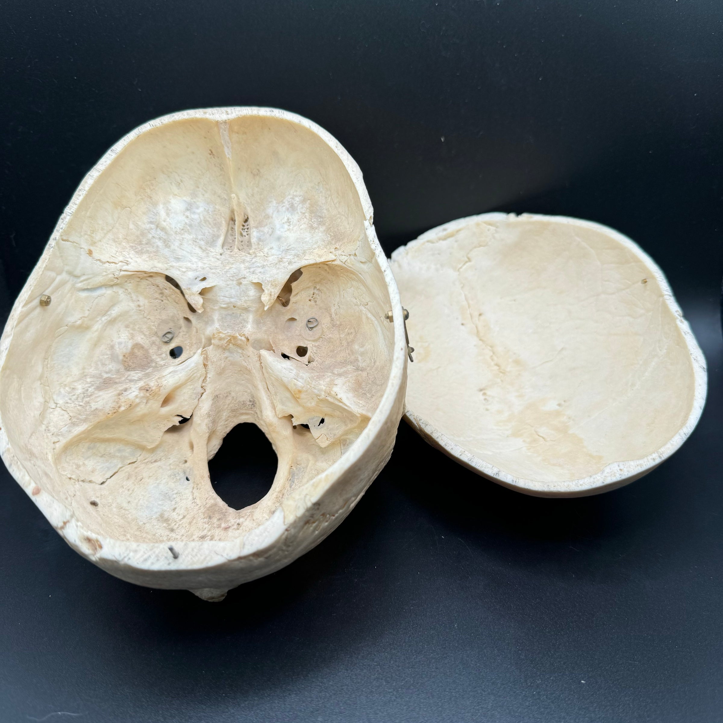Human Skull Female Medical Specimen | The Learned Lemur