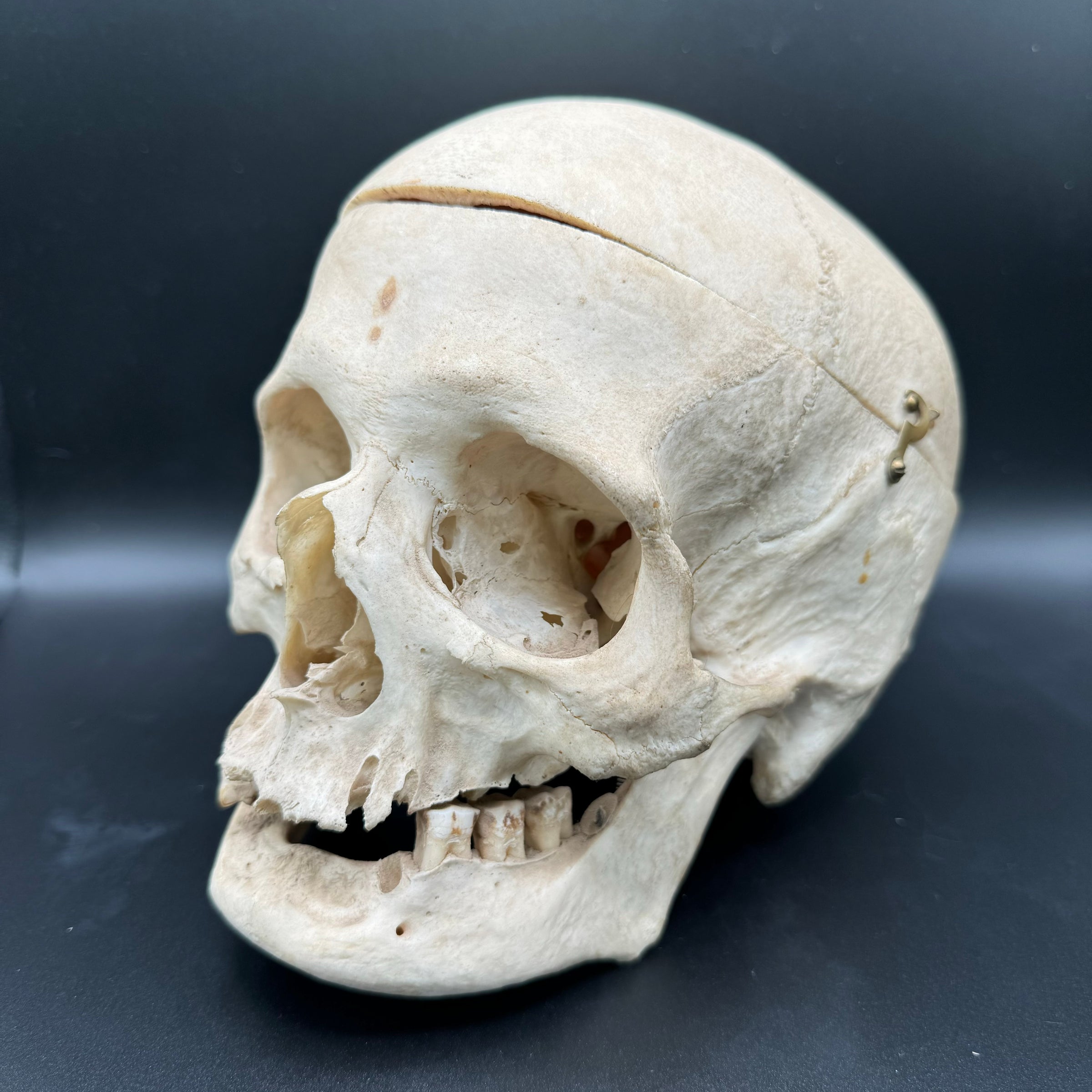 Human Skull Female Medical Specimen | The Learned Lemur