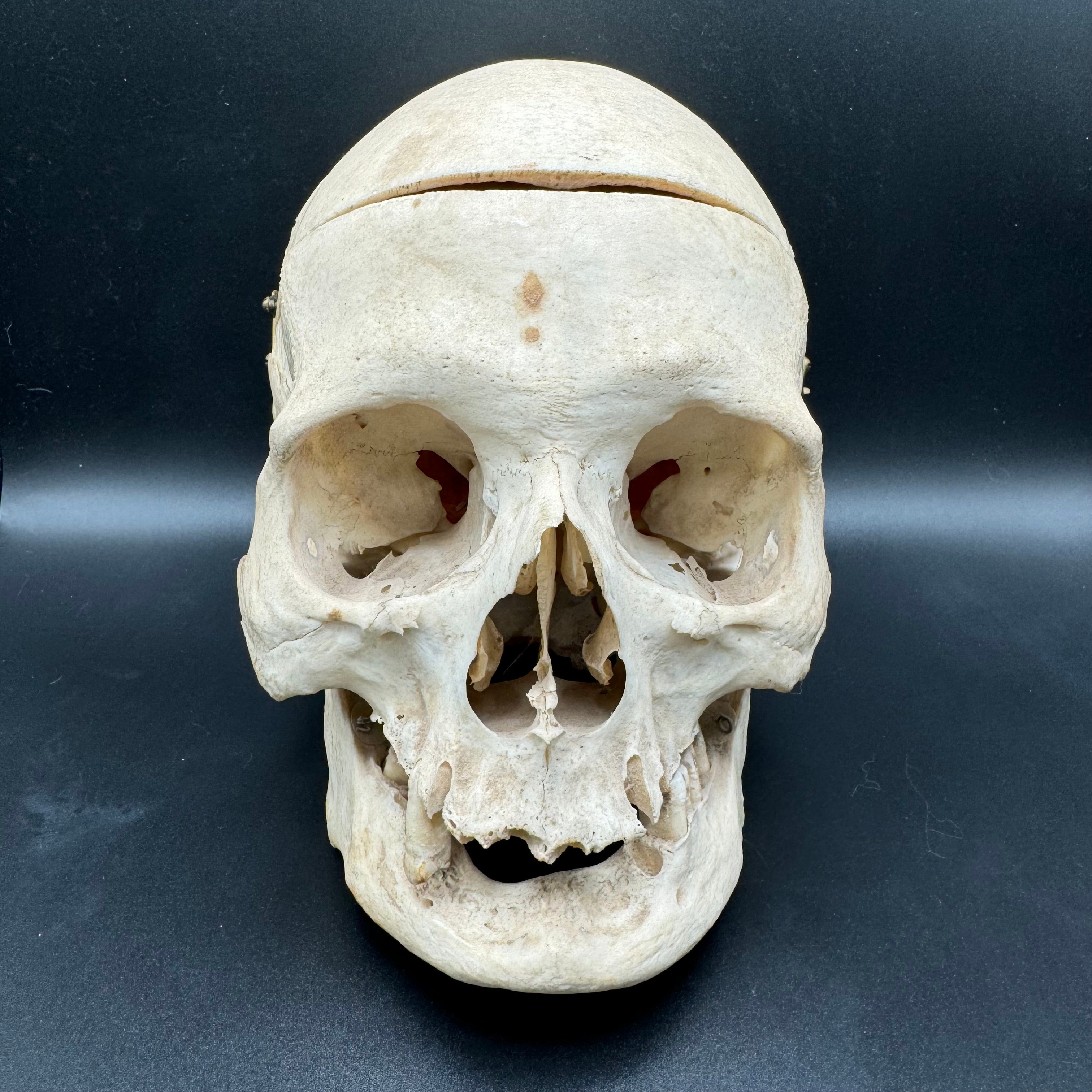 Human Skull Female Medical Specimen | The Learned Lemur