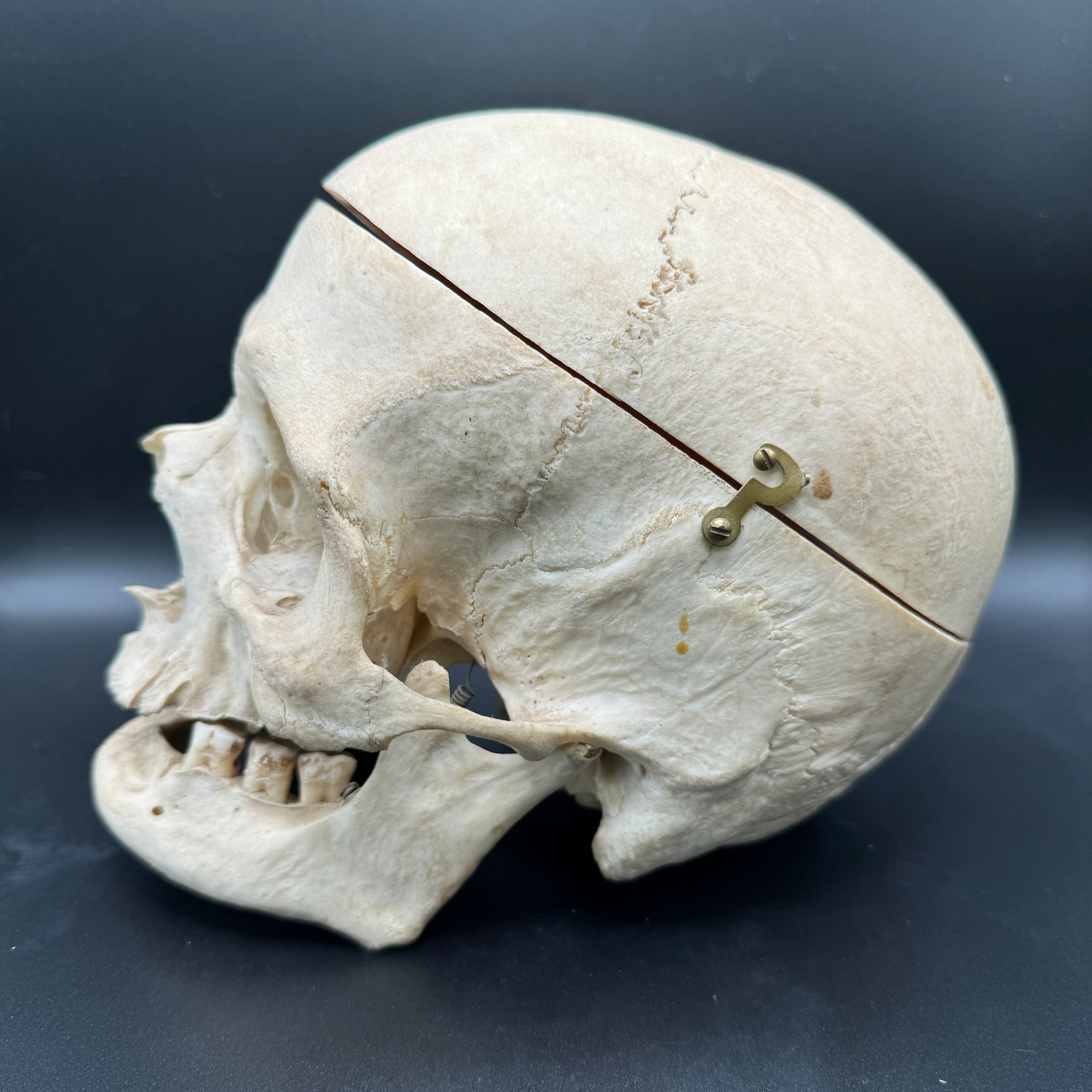 Human Skull Female Medical Specimen | The Learned Lemur